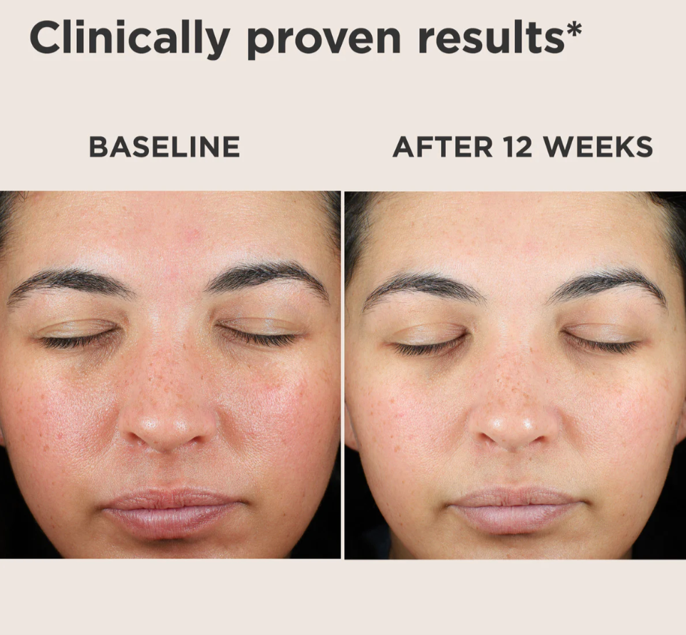 EltaMD UV Skin Recovery Red Color Correcting Green Tint Broad Spectrum SPF 50 (1.7 oz)